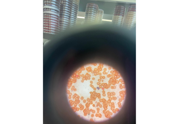 orange dots through a microscope with petri dishes in the background