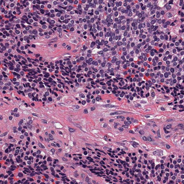 October Case of the Month